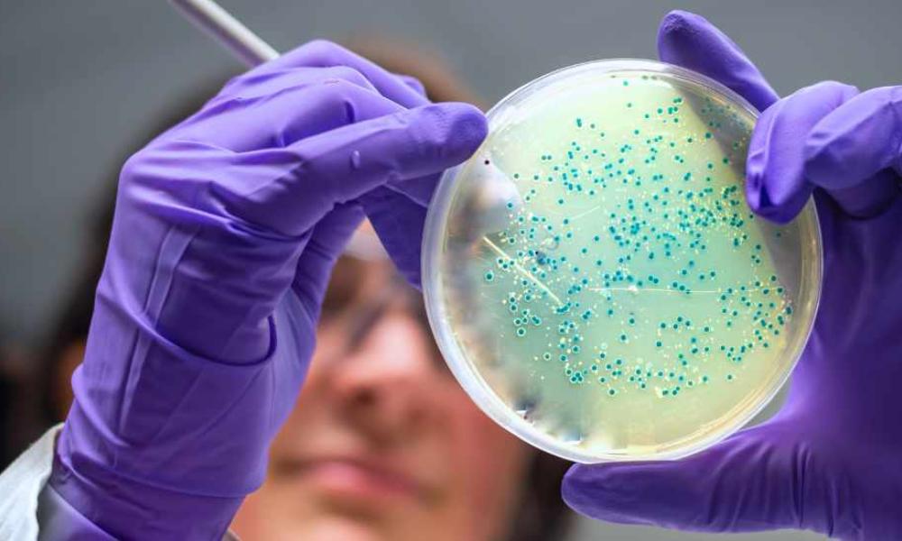 Ny EU-lov skærper kravene til Listeria-kontrol fra 2026 Ny EU-lov skærper kravene til Listeria-kontrol fra 2026